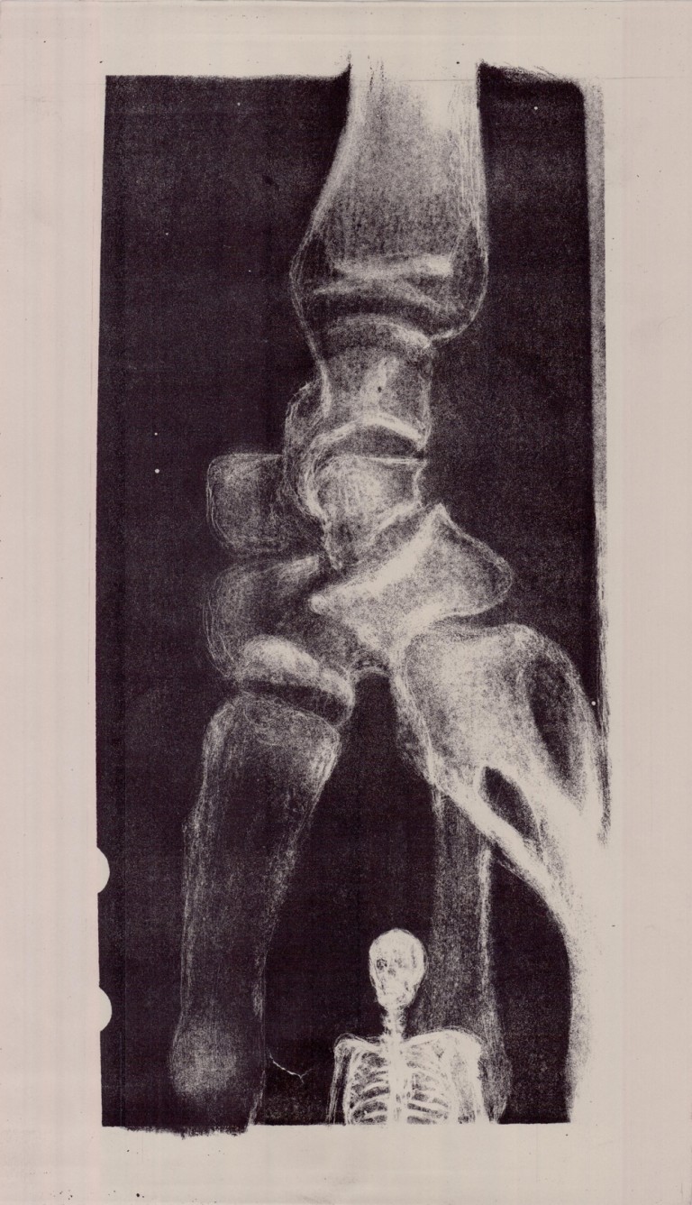 “Kráneo” for live electronics (2010)